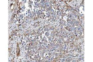 IHC analysis of EHD3 using anti-EHD3 antibody (ABIN7602777). (EHD3 Antikörper  (C-Term))