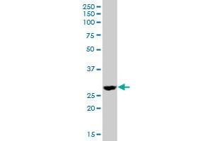 DHRS4 MaxPab polyclonal antibody. (DHRS4 Antikörper  (AA 1-278))