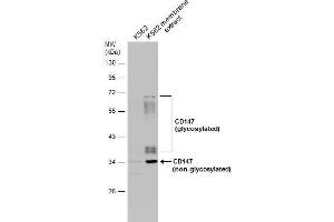 WB Image K562 whole cell and membrane extracts (30 μg) were separated by 10% SDS-PAGE, and the membrane was blotted with CD147 antibody [N2C3] , diluted at 1:500. (CD147 Antikörper)