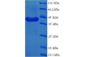 SDS-PAGE (SDS) image for Inter alpha Globulin Inhibitor H4 (ITIH4) (AA 689-930) protein (His-SUMO Tag) (ABIN5711271)