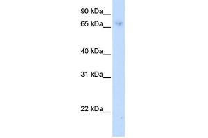 WB Suggested Anti-ZNF432 Antibody Titration:  0. (ZNF432 Antikörper  (C-Term))