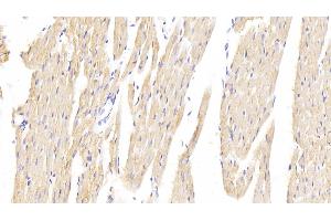 Detection of HMGCR in Rat Cardiac Muscle Tissue using Polyclonal Antibody to 3-Hydroxy-3-Methylglutaryl Coenzyme A Reductase (HMGCR) (HMGCR Antikörper  (AA 638-887))