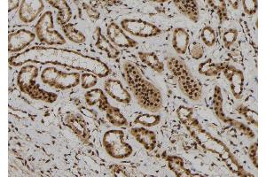 ABIN6272300 at 1/100 staining Human kidney tissue by IHC-P.