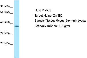 Host: Rabbit Target Name: Znf185 Sample Type: Mouse Stomach lysates Antibody Dilution: 1. (Zinc Finger Protein 185 Antikörper  (Middle Region))