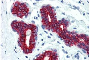 Human Breast (formalin-fixed, paraffin-embedded) stained with Keratin antibody ABIN334246 at 10 ug/ml followed by biotinylated anti-mouse IgG secondary antibody ABIN481714, alkaline phosphatase-streptavidin and chromogen. (pan Keratin Antikörper)