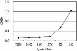 SERPING1 (Human) Matched Antibody Pair