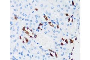 Immunohistochemistry (Paraffin-embedded Sections) (IHC (p)) image for anti-ATPase, H+ Transporting, Lysosomal 13kDa, V1 Subunit G3 (ATP6V1G3) antibody (ABIN7257870)