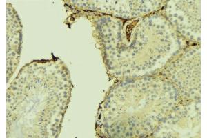 ABIN6275011 at 1/100 staining Mouse testis tissue by IHC-P. (CHPF Antikörper  (C-Term))