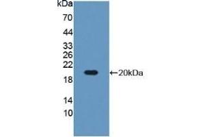 Detection of Recombinant IGFBP3, Mouse using Polyclonal Antibody to Insulin Like Growth Factor Binding Protein 3 (IGFBP3) (IGFBP3 Antikörper  (AA 152-292))