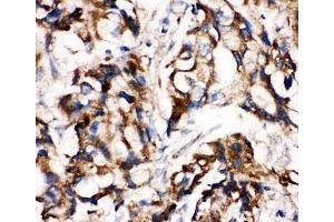 Immunohistochemistry (IHC) image for anti-Mitogen-Activated Protein Kinase Kinase 1 (MAP2K1) (C-Term) antibody (ABIN3031839)
