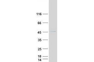 Western Blotting (WB) image for GTP Binding Protein 6 (Putative) (GTPBP6) protein (Myc-DYKDDDDK Tag) (ABIN2722362)