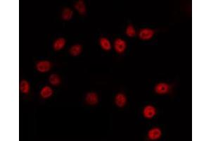 ABIN6266821 staining HuvEc by IF/ICC. (SUPT3H/SPT3 Antikörper  (Internal Region))