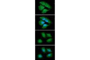 ICC/IF analysis of 14-3-3 epsilon in HeLa cells line, stained with DAPI (Blue) for nucleus staining and monoclonal anti-human 14-3-3 epsilon antibody (1:100) with goat anti-mouse IgG-Alexa fluor 488 conjugate (Green). (YWHAE Antikörper)