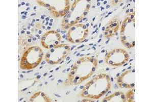 Immunohistochemistry (IHC) image for anti-Phosphoglycerate Kinase 1 (PGK1) (AA 117-145) antibody (ABIN3032224)