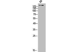 Western Blot analysis of KB cells using COL11A1 Polyclonal Antibody (COL11A1 Antikörper  (Internal Region))