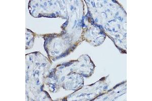 Immunohistochemistry (IHC) image for anti-Cytochrome P450, Family 19, Subfamily A, Polypeptide 1 (CYP19A1) (AA 1-180) antibody (ABIN6139316)