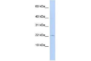 WB Suggested Anti-FKBP2 Antibody Titration: 0. (FKBP2 Antikörper  (N-Term))