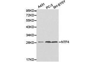 Western Blotting (WB) image for anti-Neurotrophin 4 (NTF4) antibody (ABIN1873969) (Neurotrophin 4 Antikörper)