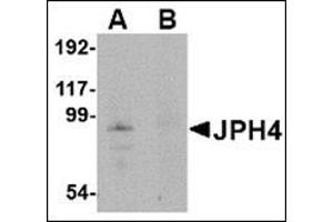 Western blot analysis of JPH4 in mouse brain tissue lysate with this product at 1 μg/ml in (A) the absence and (B) the presence of blocking peptide. (Junctophilin 4 Antikörper  (Middle Region))