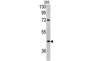 Western blot analysis of LRG1 antibody (Center) in 293 cell line lysates (35ug/lane).