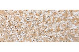 Immunohistochemistry (Paraffin-embedded Sections) (IHC (p)) image for anti-Fibronectin Type III Domain Containing 3B (FNDC3B) antibody (ABIN7252033)
