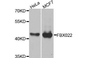 Western blot analysis of extracts of HeLa and MCF7 cell lines, using FBXO22 antibody.