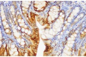 Immunohistochemistry of paraffin-embedded Mouse colon using S100A6 Polycloanl Antibody at dilution of 1:150