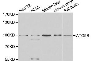 Western blot analysis of extracts of various cell lines, using ATG9B antibody (ABIN4902971) at 1:1000 dilution. (ATG9B Antikörper)