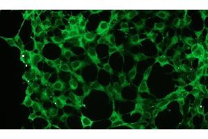 Immunocytochemistry (ICC) image for anti-Protein Kinase C, zeta (PRKCZ) antibody (ABIN870323) (PKC zeta Antikörper)
