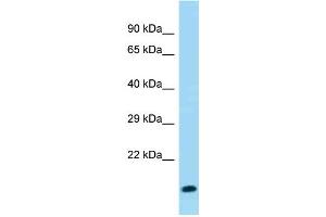 WB Suggested Anti-Gm8008 Antibody Titration: 1. (Gm8008 Antikörper  (C-Term))