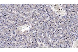 Detection of MASP2 in Human Liver Tissue using Monoclonal Antibody to Mannose Associated Serine Protease 2 (MASP2) (Mannose Associated Serine Protease 2 (AA 170-287) Antikörper)