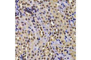 Immunohistochemistry of paraffin-embedded mouse kidney using WHSC1 antibody (ABIN6128925, ABIN6150213, ABIN6150214 and ABIN6223939) at dilution of 1:100 (40x lens). (WHSC1 Antikörper  (AA 1-240))