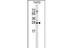 ZT2 Antibody (C-term) (ABIN656733 and ABIN2845957) western blot analysis in T47D cell line lysates (35 μg/lane). (ZMAT2 Antikörper  (C-Term))