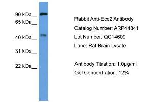 WB Suggested Anti-Ece2  Antibody Titration: 0. (ECE2 Antikörper  (Middle Region))