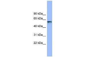 WB Suggested Anti-IL18R1 Antibody Titration:  0. (IL18R1 Antikörper  (N-Term))