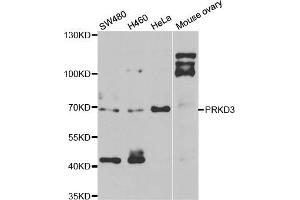 Western blot analysis of extracts of various cell lines, using PRKD3 antibody (ABIN5974259) at 1/1000 dilution.