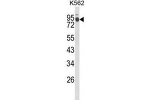 Western Blotting (WB) image for anti-Interleukin 1 Receptor Accessory Protein-Like 2 (IL1RAPL2) antibody (ABIN3003924)
