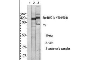 Western Blot (WB) analysis of specific cells using Phospho-EphB1/2 (Y594/604) Polyclonal Antibody. (EPHB1/2 Antikörper  (pTyr594, pTyr604))