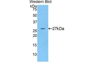 Western blot analysis of the recombinant protein. (ADAM10 Antikörper  (AA 218-445))