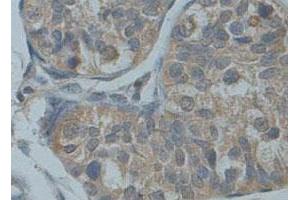 Immunohistochemical staining of formalin-fixed paraffin-embedded human fetal testis tissue showing membrane staining with ADAM30 polyclonal antibody  at 1 : 100 dilution. (ADAM30 Antikörper  (Internal Region))