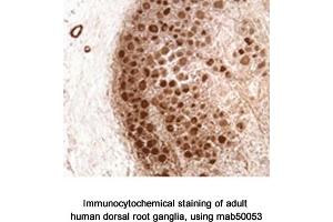 Image no. 2 for anti-Neurofibromin 1 (NF1) (N-Term) antibody (ABIN363207) (Neurofibromin 1 Antikörper  (N-Term))