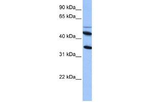 WB Suggested Anti-IL13RA2 Antibody Titration: 0. (IL13RA2 Antikörper  (Middle Region))