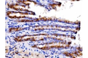 IHC analysis of AGPAT2 using anti-AGPAT2 antibody (ABIN7602435). (AGPAT2 Antikörper  (AA 77-178))