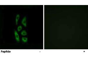 Immunofluorescence analysis of A-549 cells, using ACOT12 polyclonal antibody . (ACOT12 Antikörper)