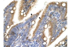 TRPM5 antibody was used for immunohistochemistry at a concentration of 4-8 ug/ml to stain Epithelial cells of intestinal villus (arrows) in Human Intestine.