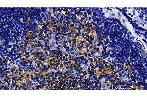 Immunohistochemistry (IHC) image for anti-Toll-Like Receptor 5 (TLR5) (AA 325-644) antibody (ABIN7444148)
