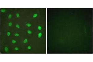 Immunofluorescence analysis of HeLa cells treated with PMA 125ng/ml 30', using MEF2A (Phospho-Ser408) Antibody. (MEF2A Antikörper  (pSer408))