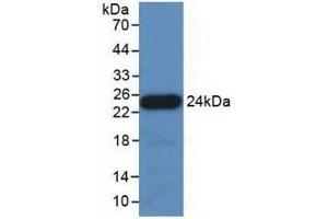 Detection of Recombinant APOE, Porcine using Polyclonal Antibody to Apolipoprotein E (APOE) (APOE Antikörper  (AA 16-175))