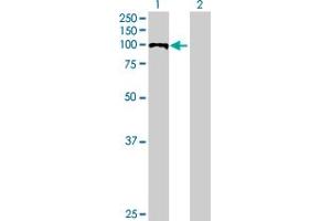 Western Blot analysis of PDCD6IP expression in transfected 293T cell line by PDCD6IP MaxPab polyclonal antibody. (ALIX Antikörper  (AA 1-868))