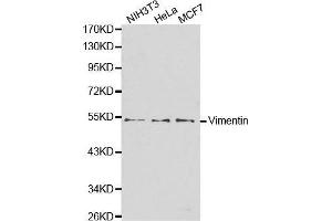 Western blot analysis of extracts of various cell lines, using VIM antibody. (Vimentin Antikörper)